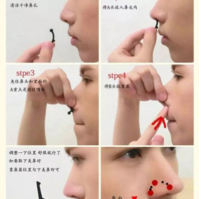 نوز سکرت (اسپلینت لیفت بینی) 3D nose lift